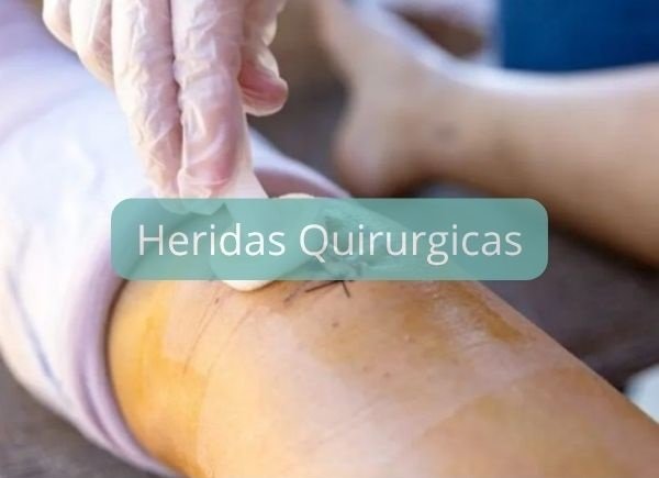 valor de curaciones a domicilio